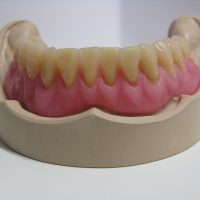 Home implantologia riabilitazioni full arch (16)