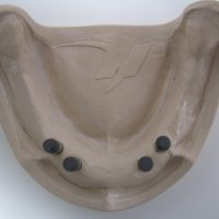 Home implantologia riabilitazioni full arch (18)