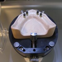 Home implantologia riabilitazioni full arch (19)