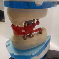 Home implantologia riabilitazioni full arch (3)