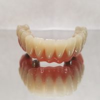 Home implantologia riabilitazioni full arch (6)