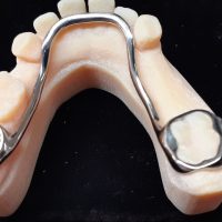 Home ortodonzia (10)