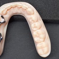 Home ortodonzia (11)