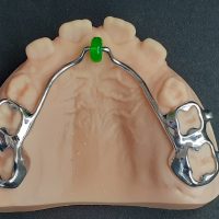 Home ortodonzia (14)