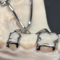 Home ortodonzia (17)