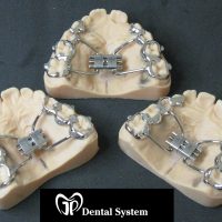 Home ortodonzia (23)