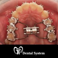 Home ortodonzia (24)