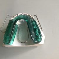 Home ortodonzia (28)