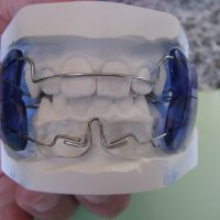 Home ortodonzia (30)