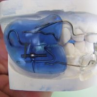 Home ortodonzia (31)