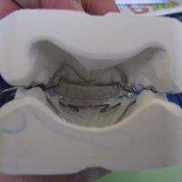 Home ortodonzia (32)