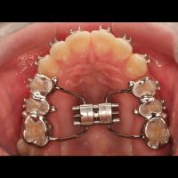 Home ortodonzia (33)