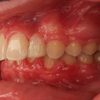 Home ortodonzia (39)