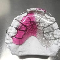 Home ortodonzia (43)