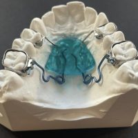 Home ortodonzia (44)