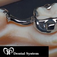 Home ortodonzia (47)