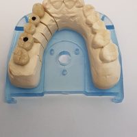 Home protesi fissa (11)