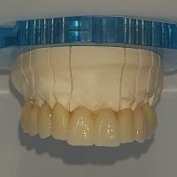 Home protesi fissa (12)