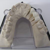 Home protesi fissa (7)