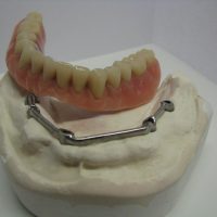 Home protesi mob. comb. (1)