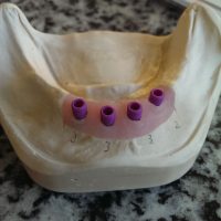 Home protesi mob. comb. (1)