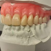 Home protesi mob. comb. (10)