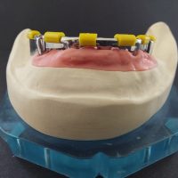 Home protesi mob. comb. (14)