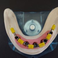 Home protesi mob. comb. (15)