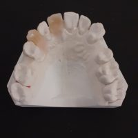 Home protesi mob. comb. (19)