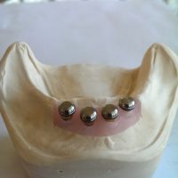 Home protesi mob. comb. (2)