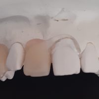 Home protesi mob. comb. (20)