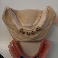 Home protesi mob. comb. (22)