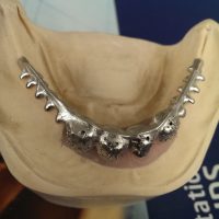 Home protesi mob. comb. (24)