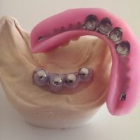 Home protesi mob. comb. (25)