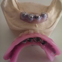 Home protesi mob. comb. (26)