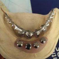 Home protesi mob. comb. (3)