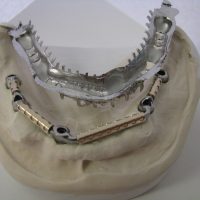 Home protesi mob. comb. (33)