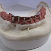 Home protesi mob. comb. (34)