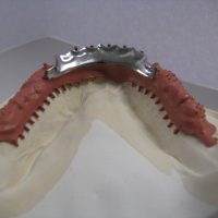 Home protesi mob. comb. (35)