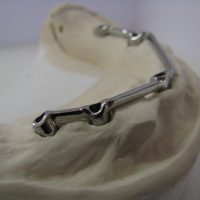 Home protesi mob. comb. (5)