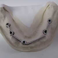 Home protesi mob. comb. (6)