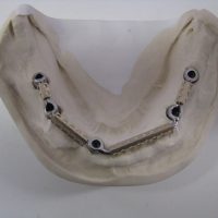 Home protesi mob. comb. (7)