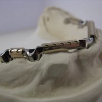 Home protesi mob. comb. (8)