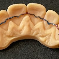 Home retainer digitali (1)