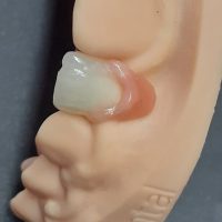 Home retainer digitali (10)