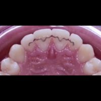 Home retainer digitali (11)