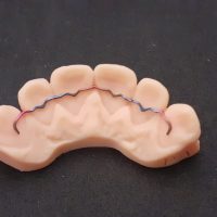 Home retainer digitali (13)