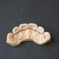 Home retainer digitali (14)