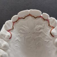 Home retainer digitali (15)