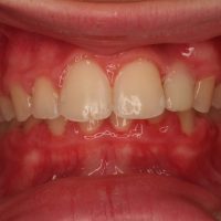 Home retainer digitali (2)